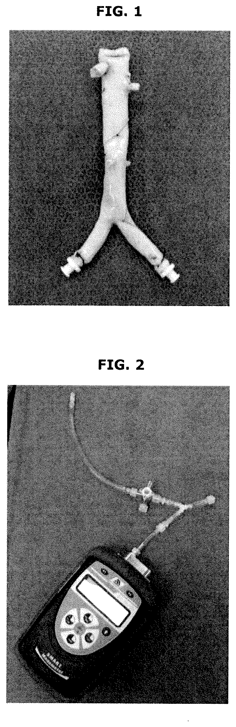 Aortoiliac implant and processing and uses thereof