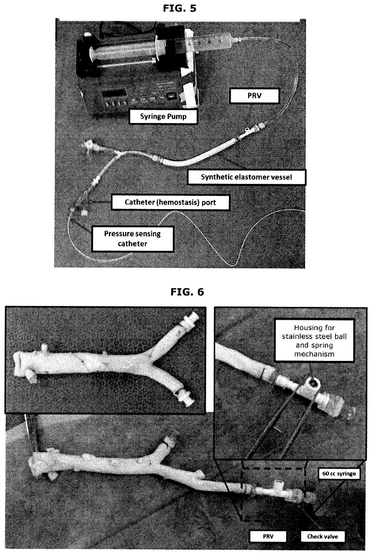 Aortoiliac implant and processing and uses thereof