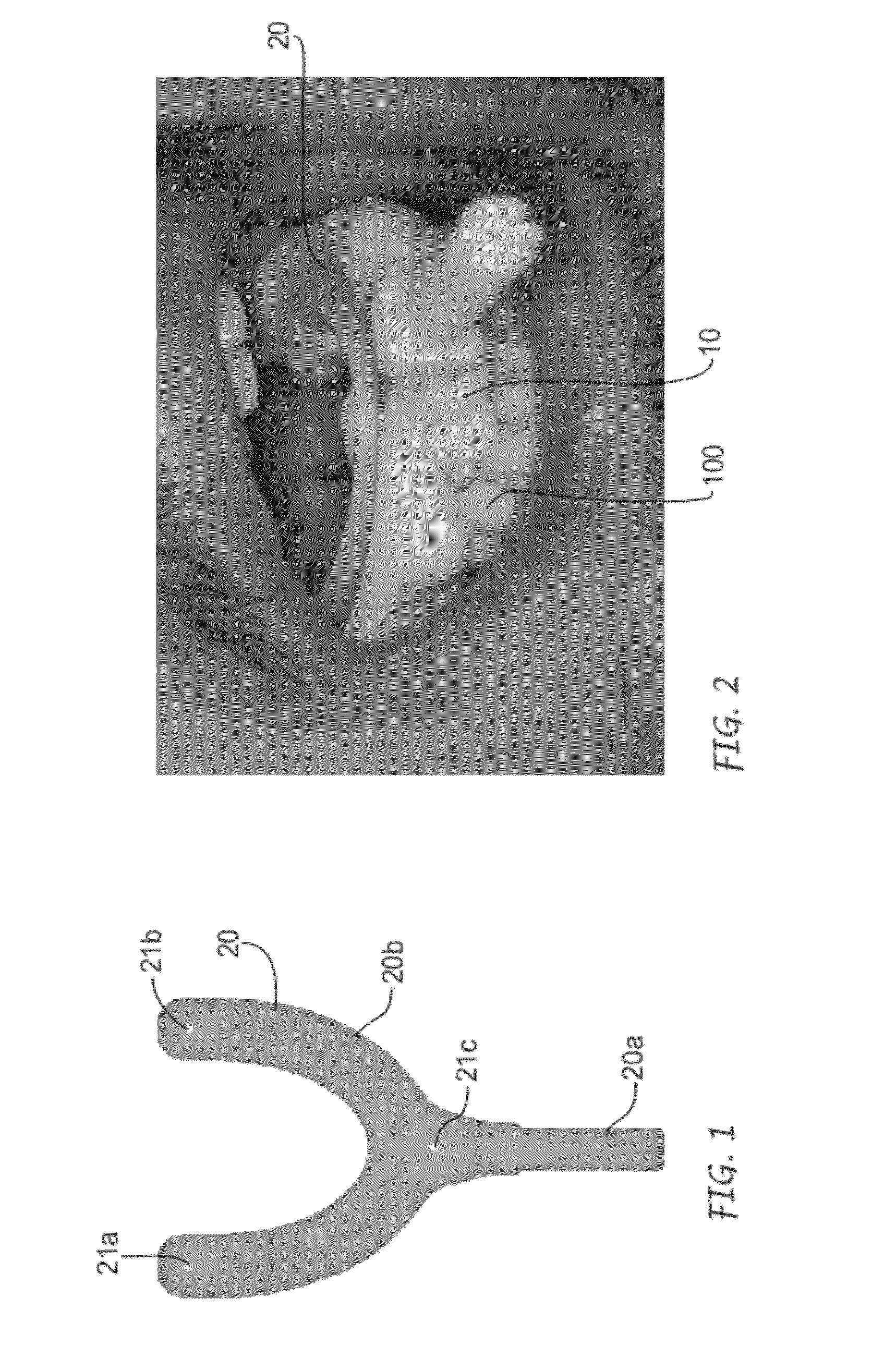 Method for preparing a surgical mask for the installation of dental implants