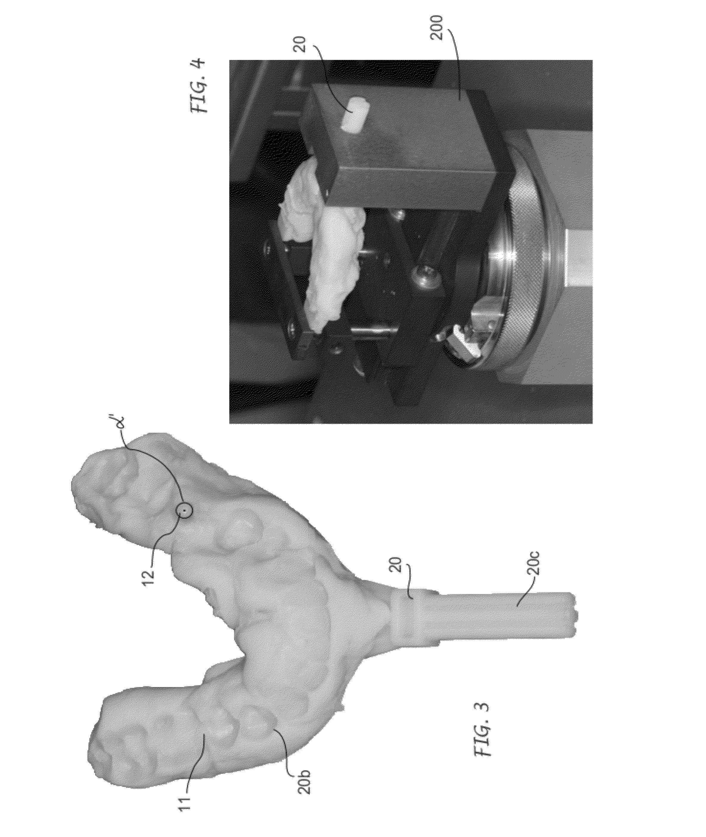 Method for preparing a surgical mask for the installation of dental implants