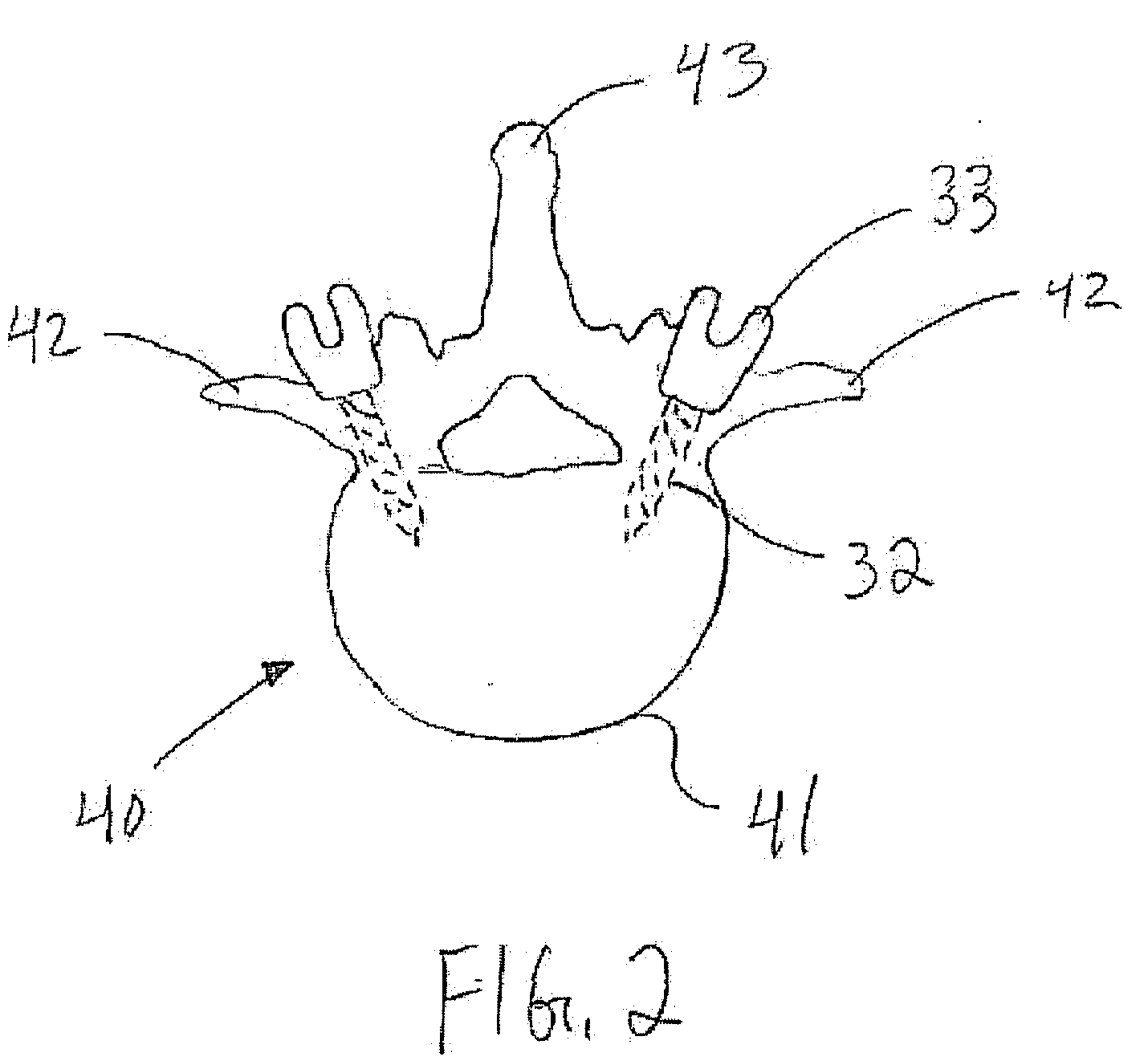 Percutaneous spinal rod insertion system and related methods