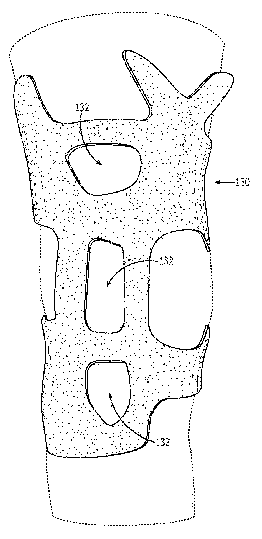 Support with removable pressure/alignment ring