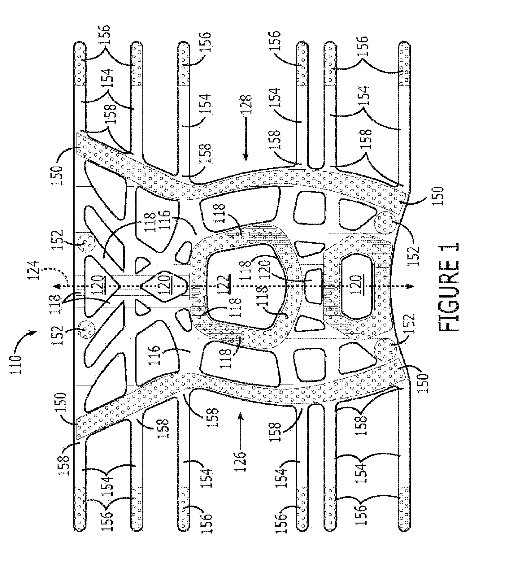 Support with removable pressure/alignment ring