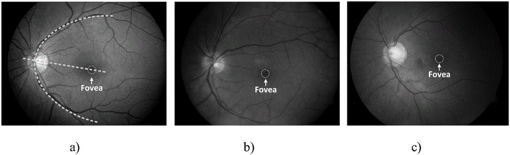 Retina fovea centralis detection method based on multi-feature model