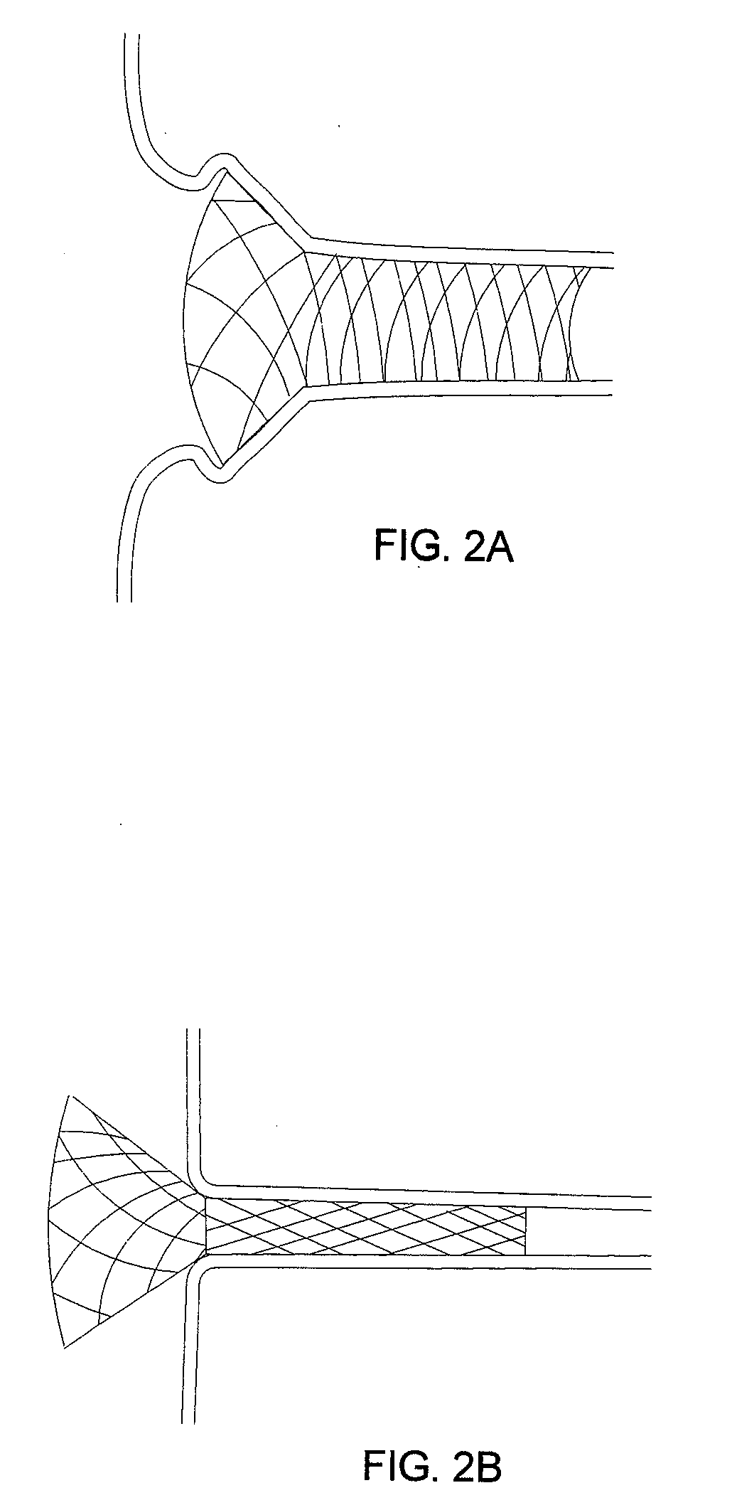 Flared stents and apparatus and methods for delivering them