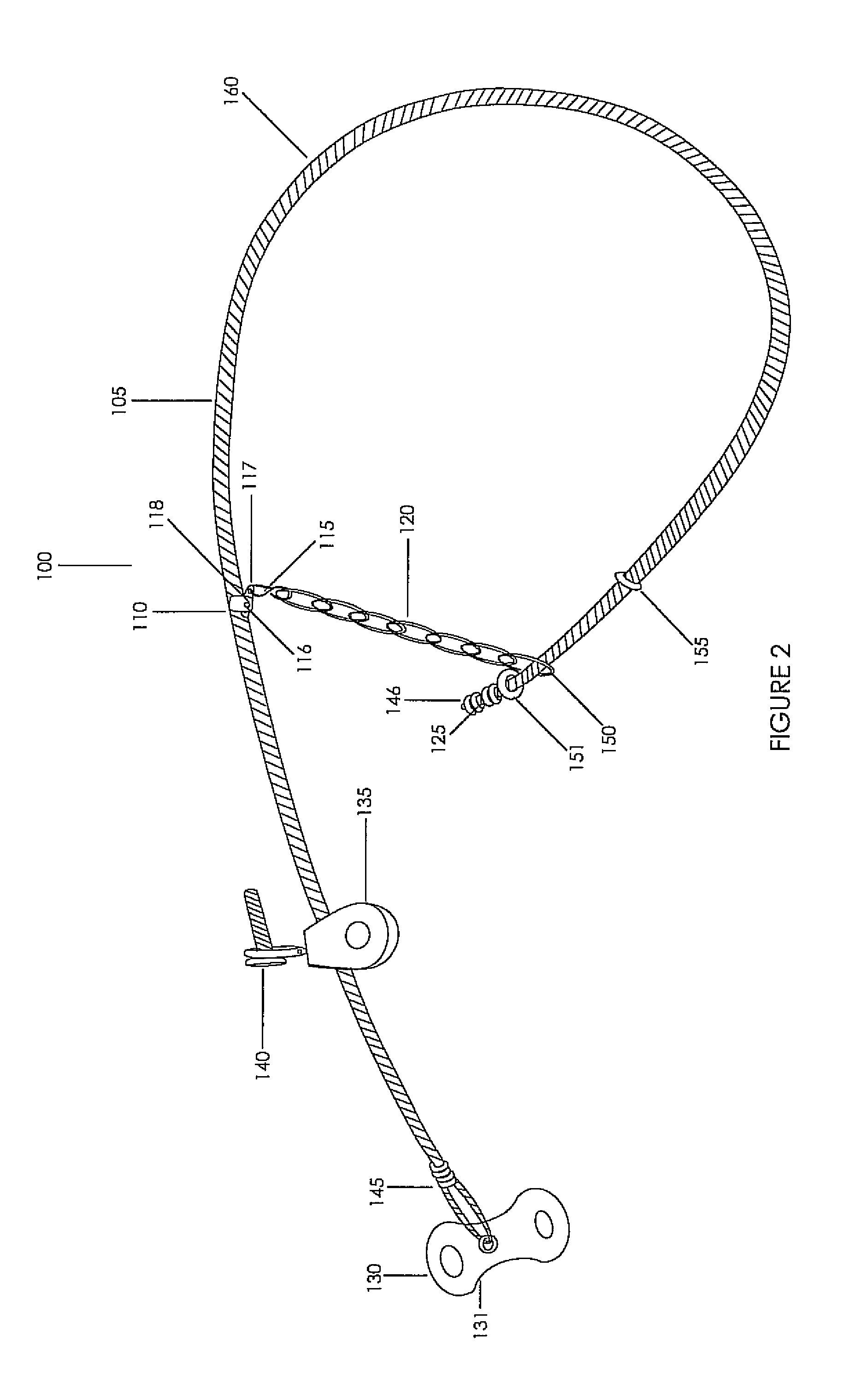 Foot snare device