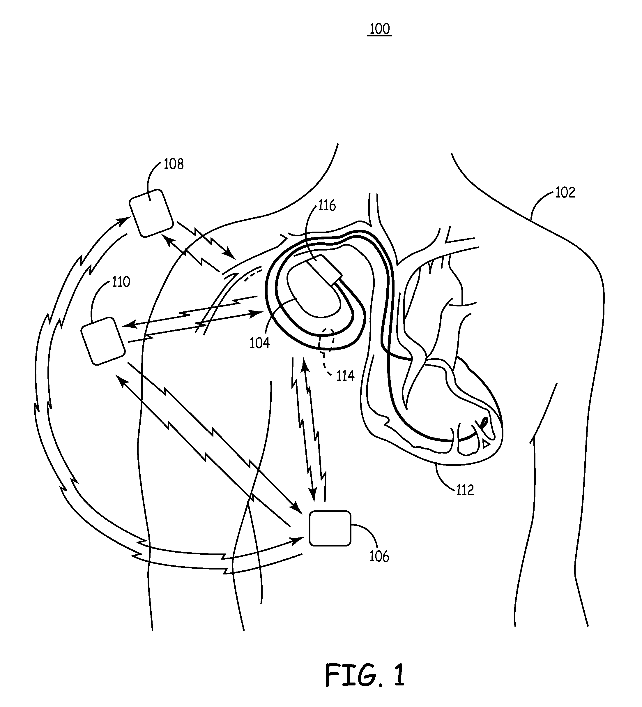 Variable implantable medical device power characteristics based upon implant depth