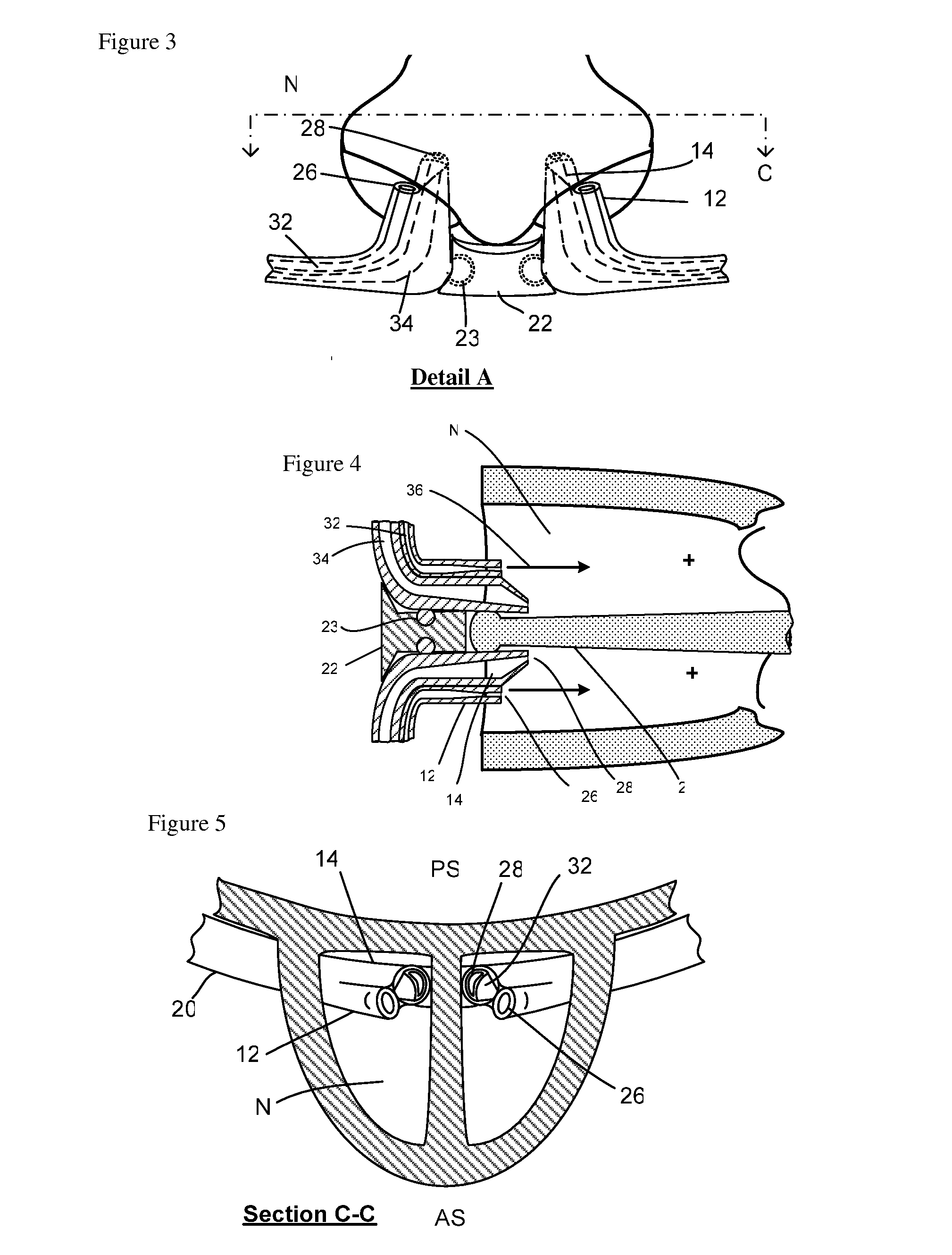 Nasal Ventilation Cannula System and Methods