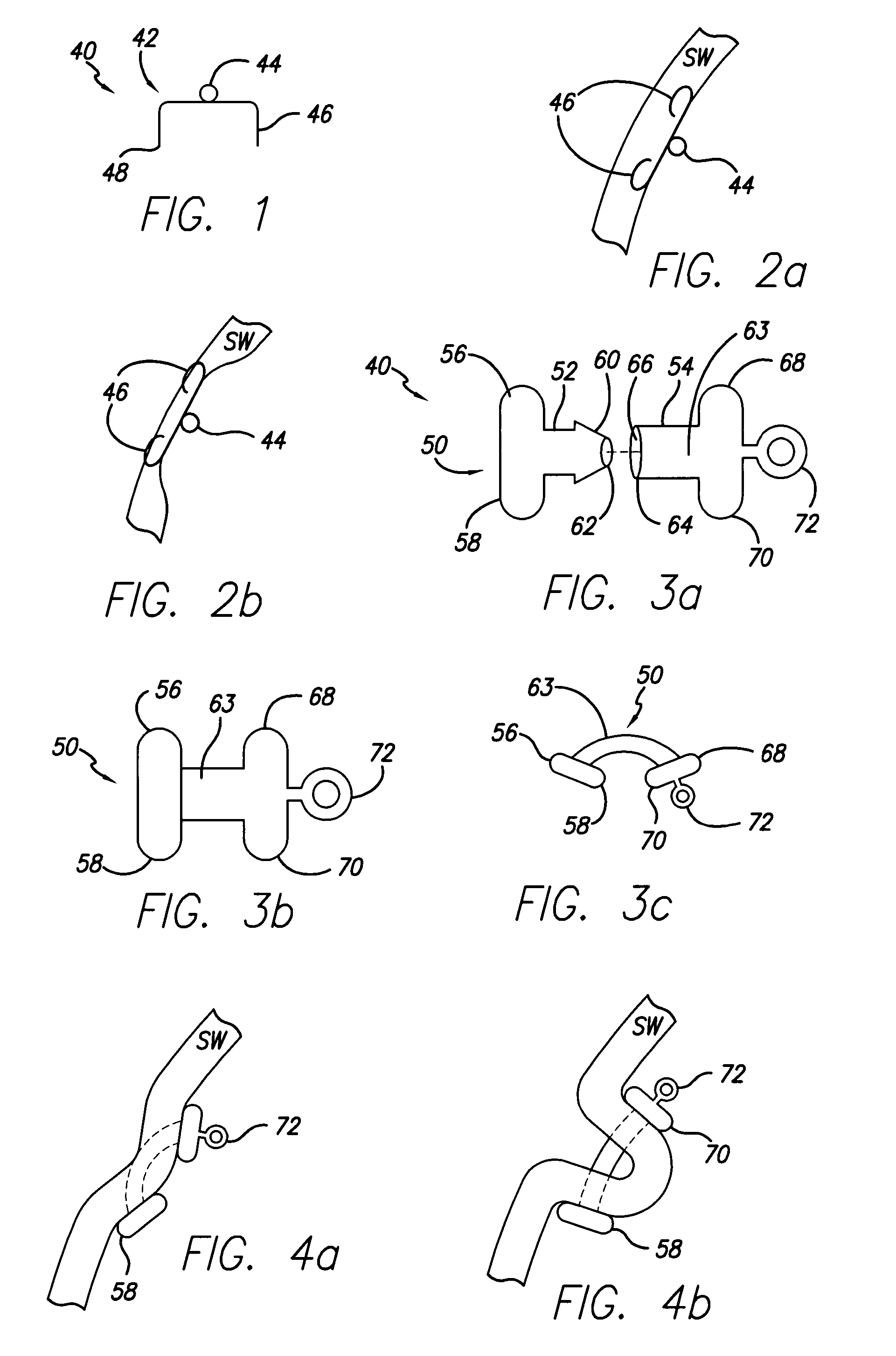 Methods and devices for reducing hollow organ volume