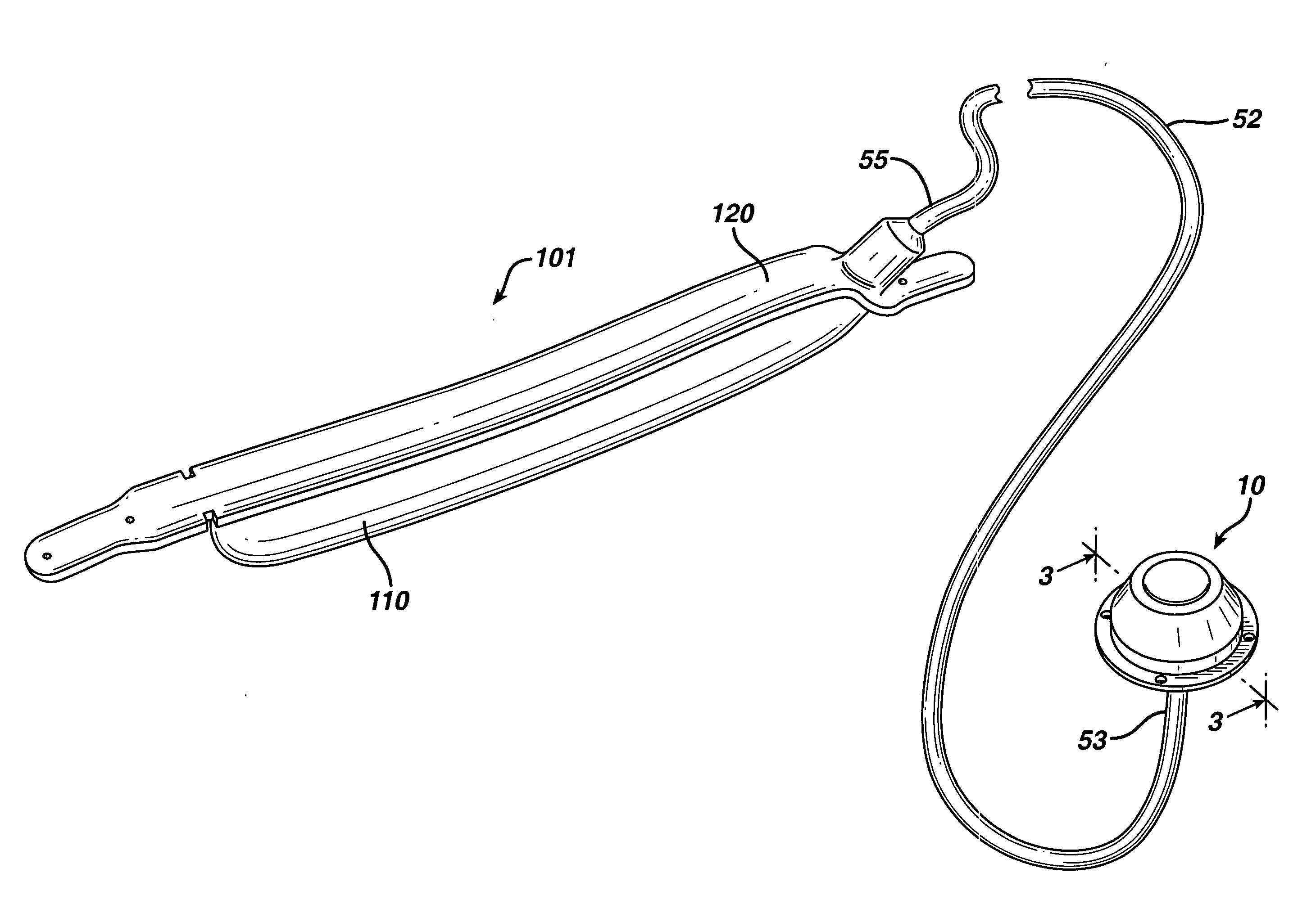 Method of implanting a fluid injection port