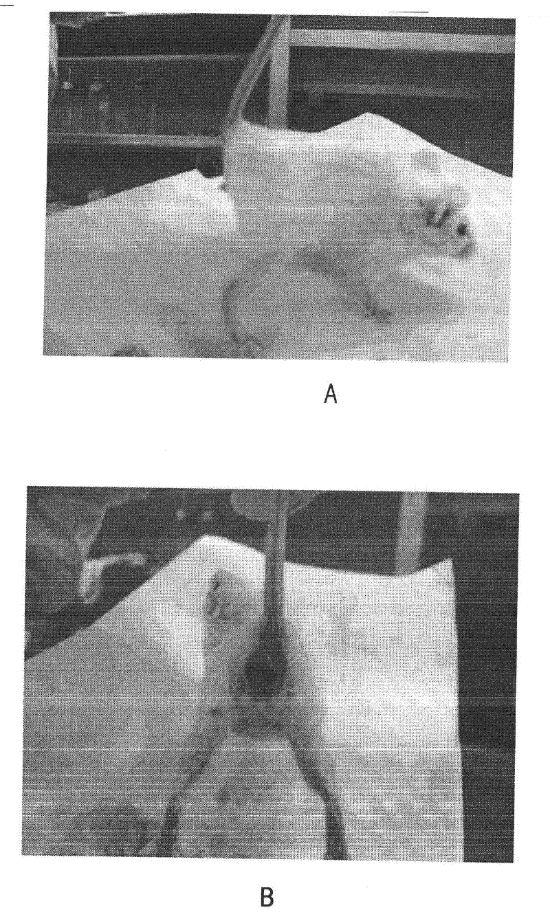 Pharmaceutical composition containing medicinal calcium salt for early preventing colorectal adenoma or colorectal cancer
