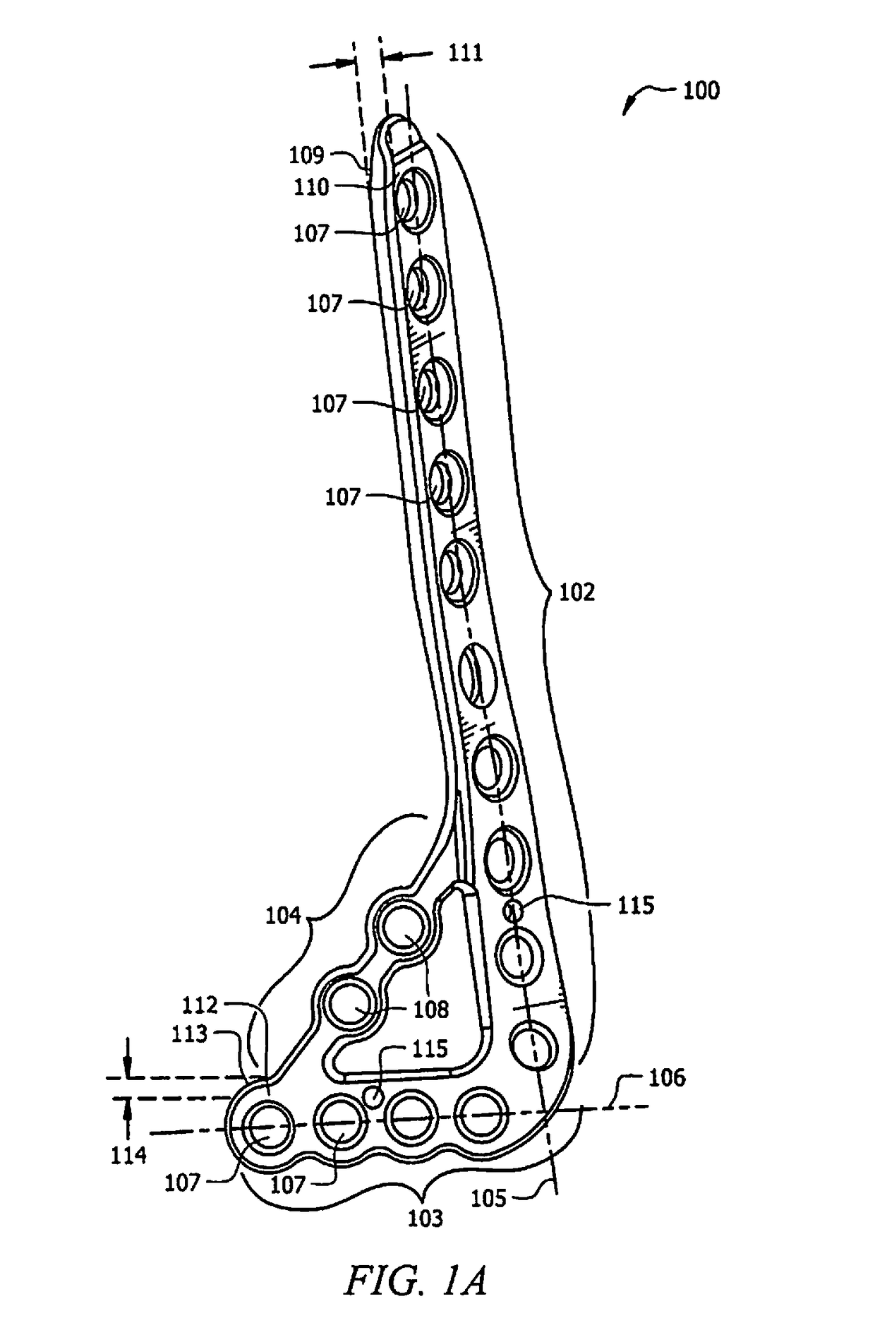 Ankle tibia plates