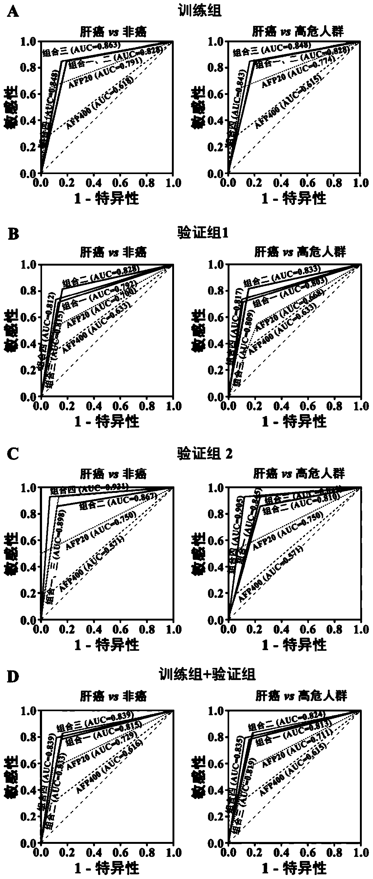 Application of serum microRNA in diagnosis of liver cancer and diagnostic kit