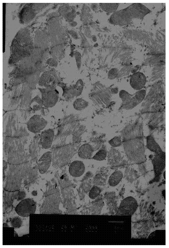 Compound sodium bicarbonate injection and preparation method thereof