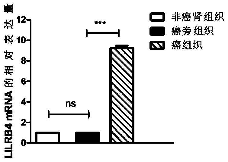 Renal clear cell carcinoma related biomarkers and their application