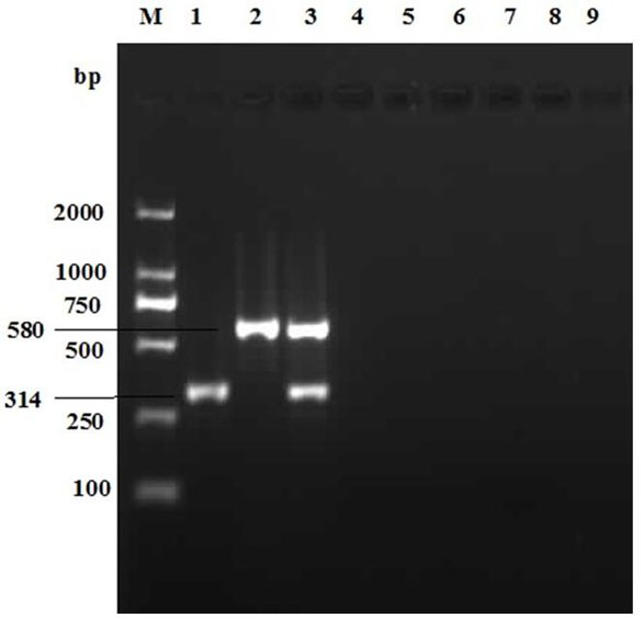 Primers and kits for double PCR detection of duck adenovirus type 2 and duck adenovirus type A