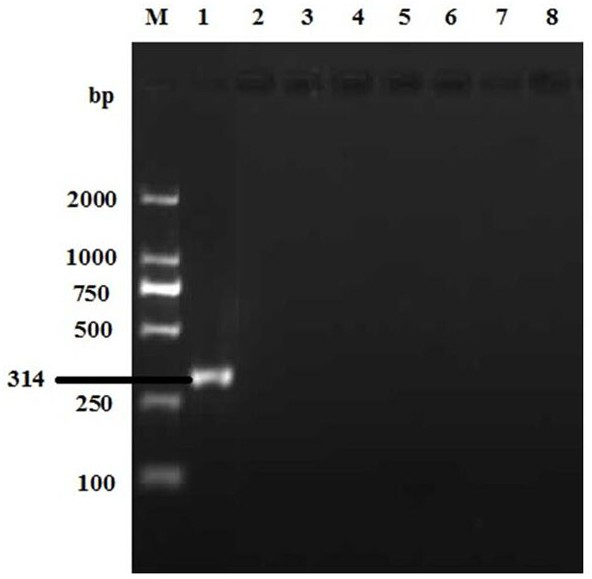 Primers and kits for double PCR detection of duck adenovirus type 2 and duck adenovirus type A