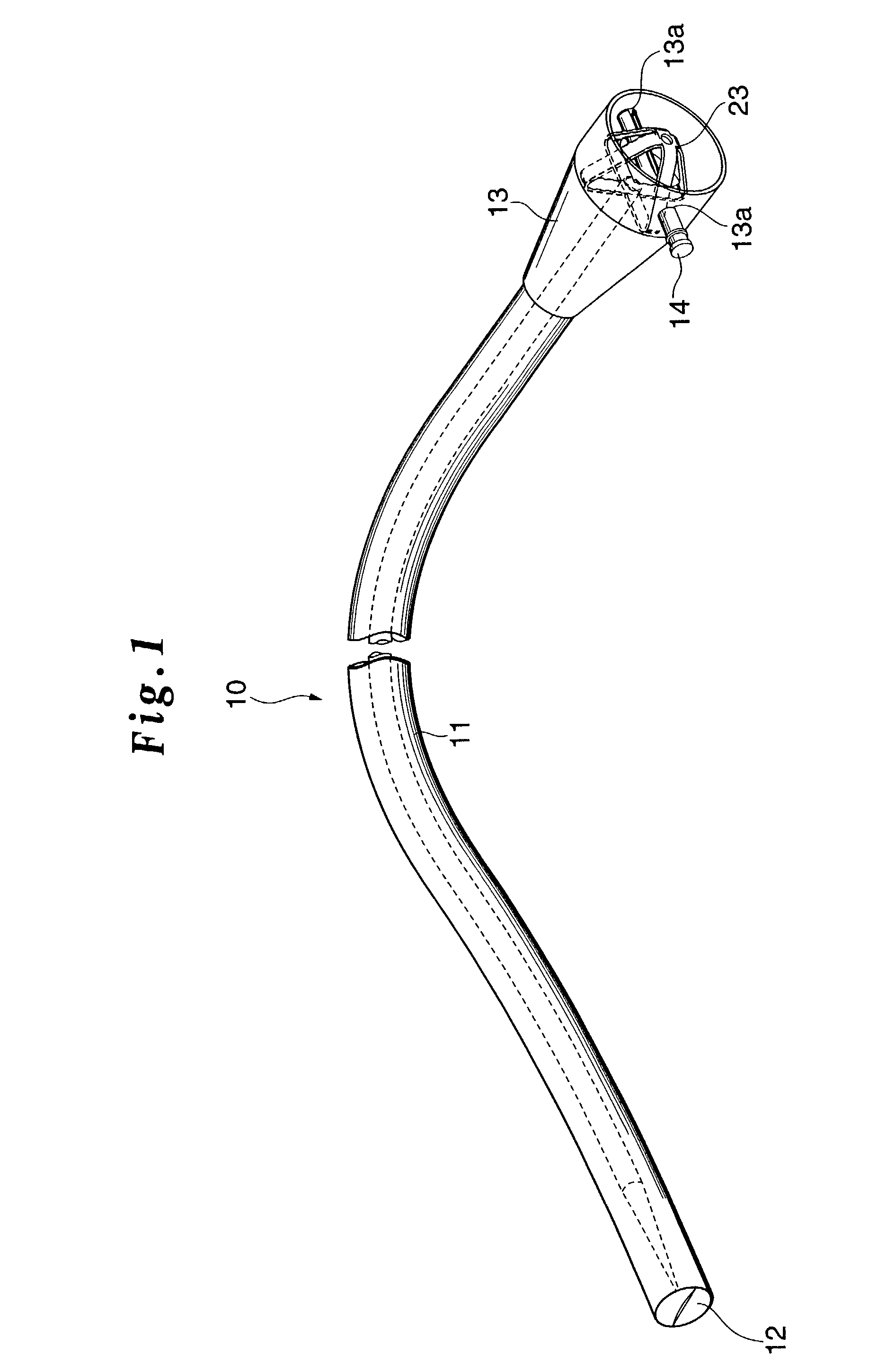 Method of gastrostomy, and an infection preventive cover, or catheter kit, and a gastrostomy catheter