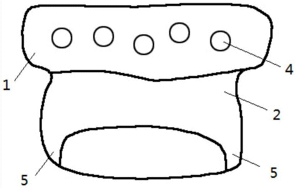 Personalized temporal-mandibular joint fossa implant