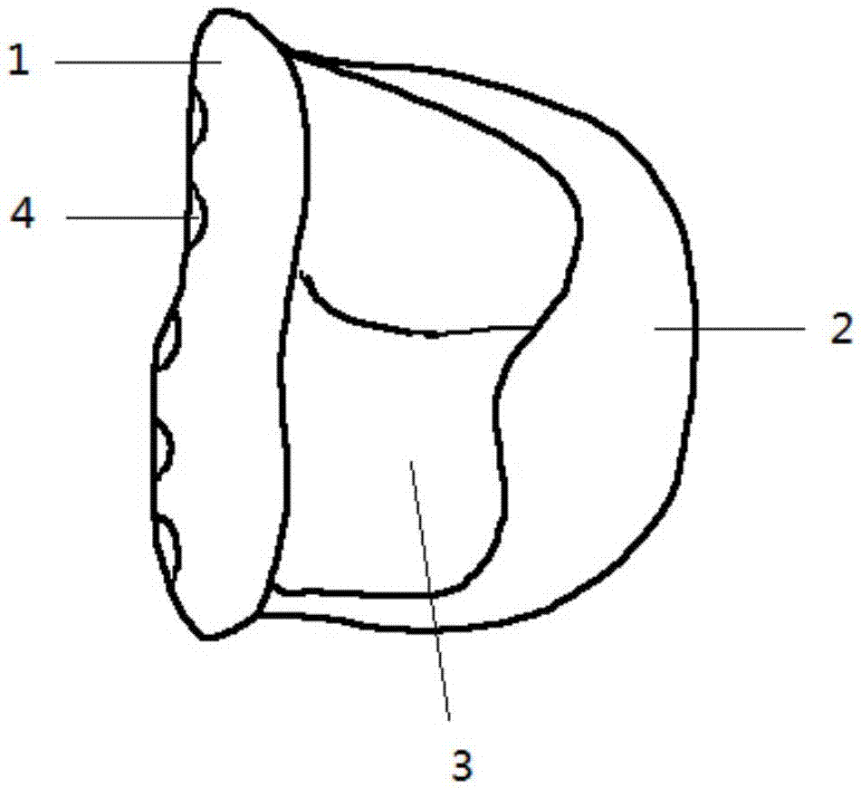 Personalized temporal-mandibular joint fossa implant