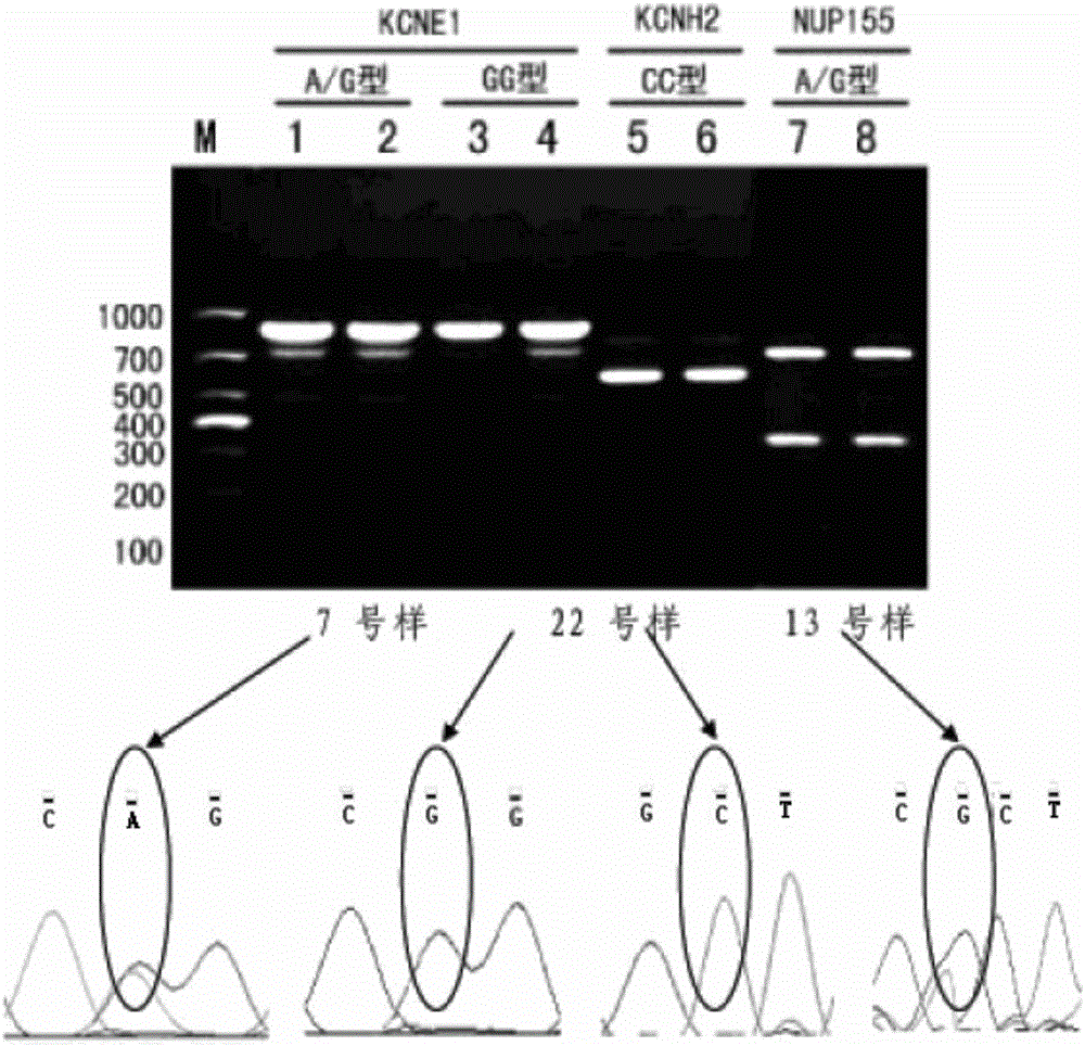 Sudden cardiac death rapid gene detection kit and detection method