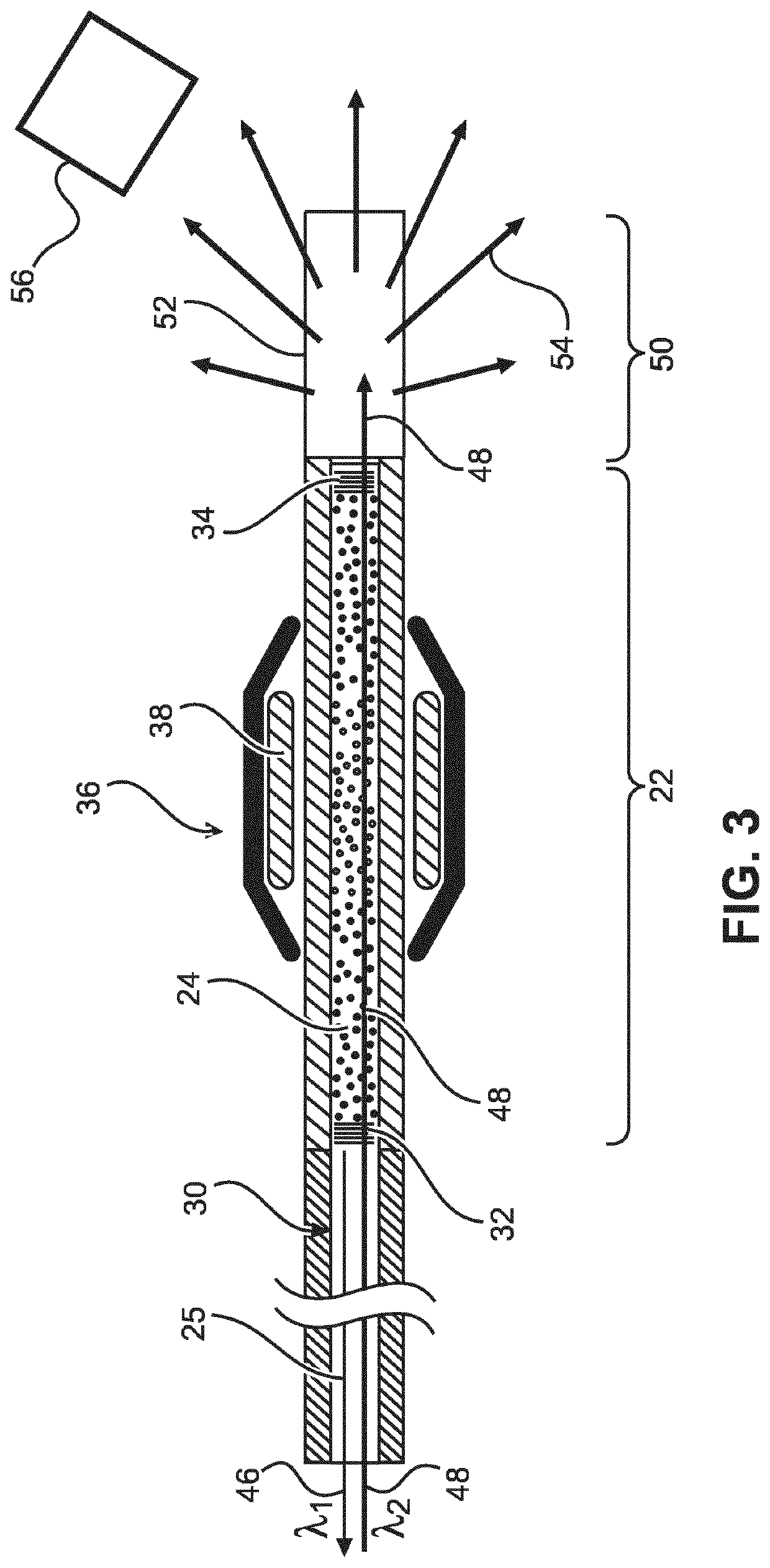 Supply of a sensor of an interventional device