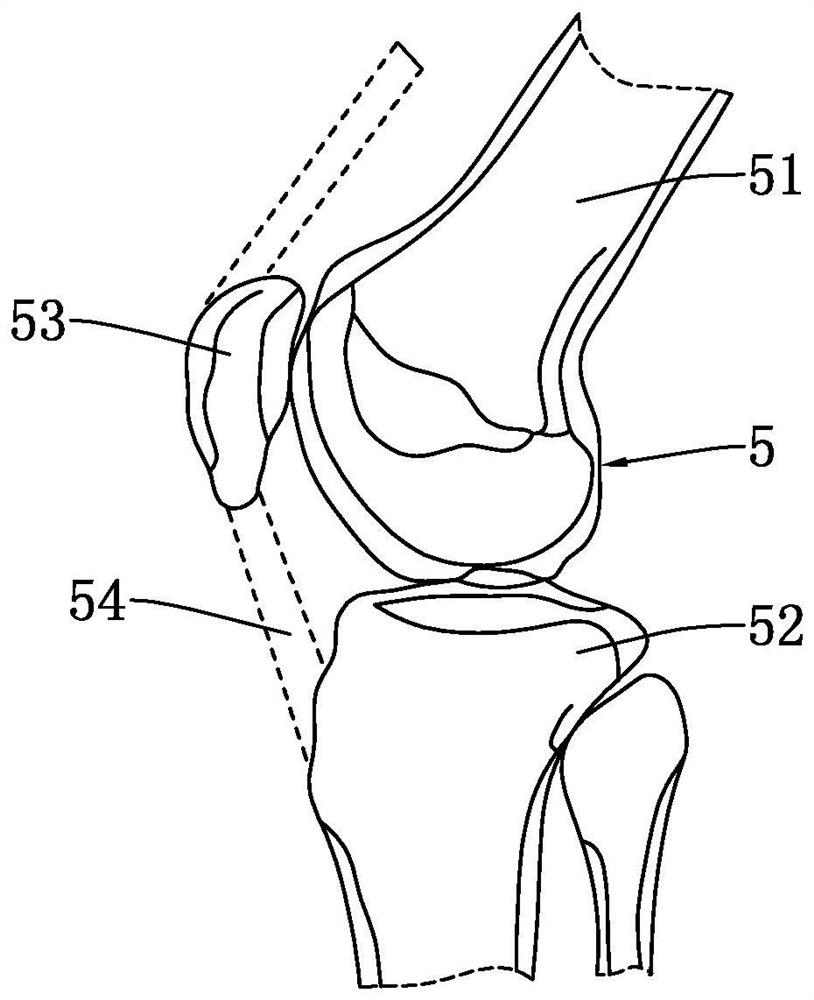 Bionic stable unicompartmental knee joint tibial plateau pad and knee joint prosthesis applying same