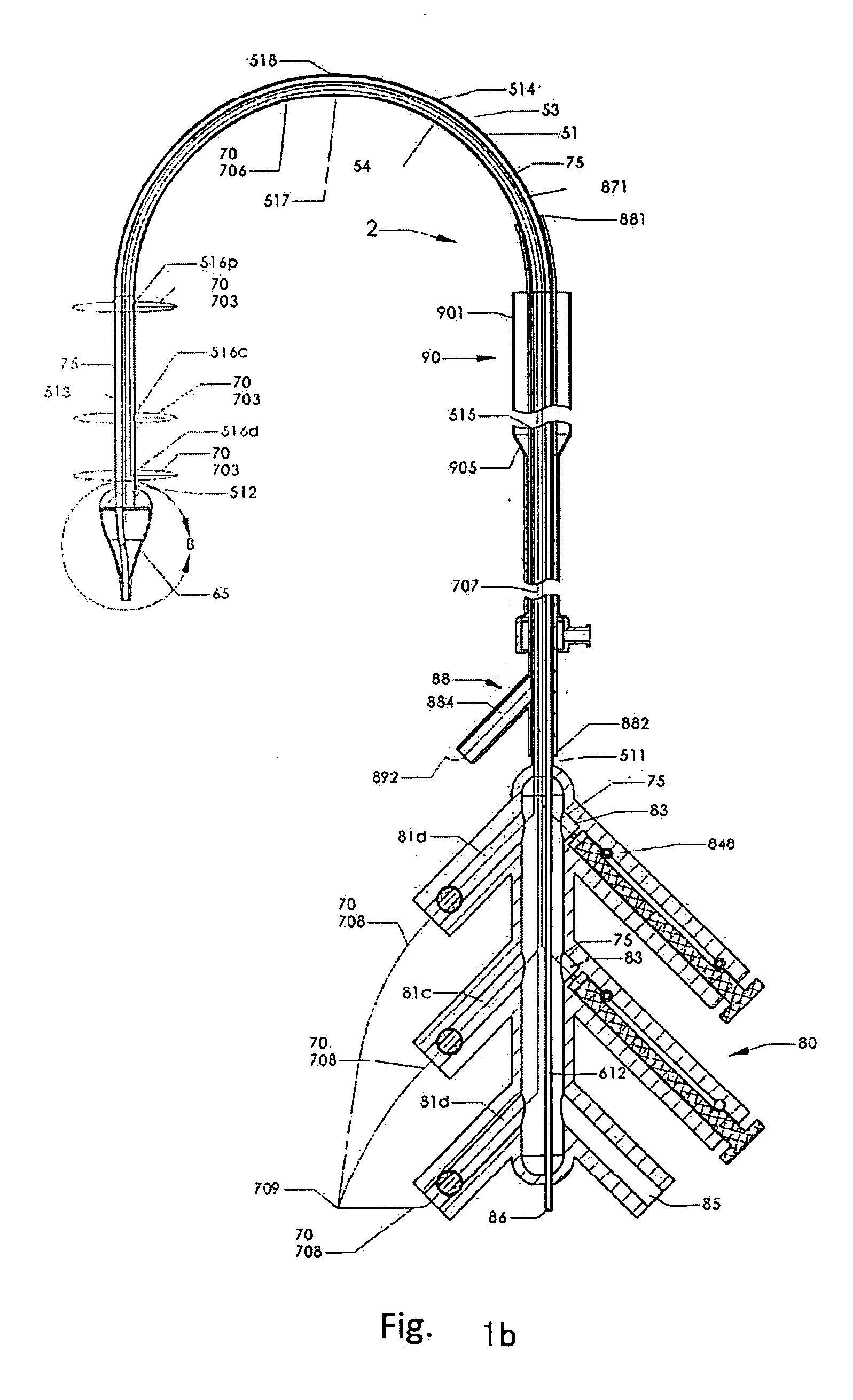 Delivery Device for Delivering a Self-Expanding Stent
