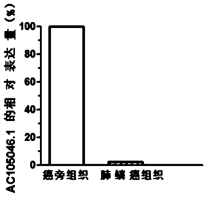 Application of differentially expressed lncRNA to diagnosis and treatment of lung cancer