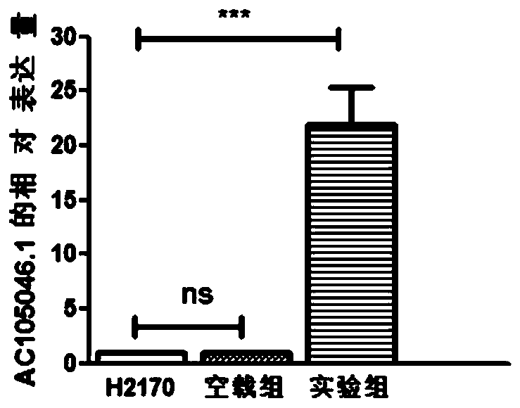 Application of differentially expressed lncRNA to diagnosis and treatment of lung cancer