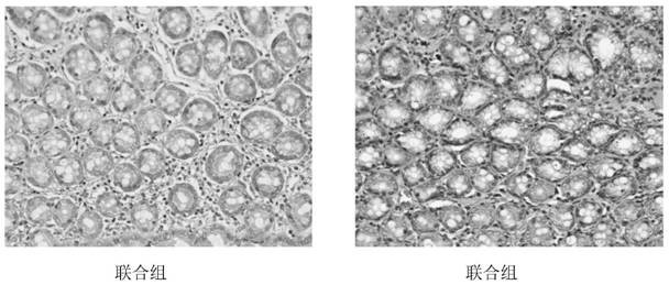 IBS-D experimental animal model method for improving modeling rate and reducing death rate