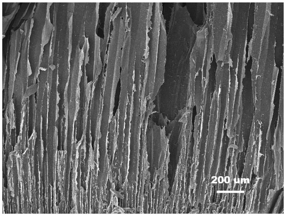 Chitosan-based gel material with double-layer-anisotropic structure as well as preparation method and application of chitosan-based gel material