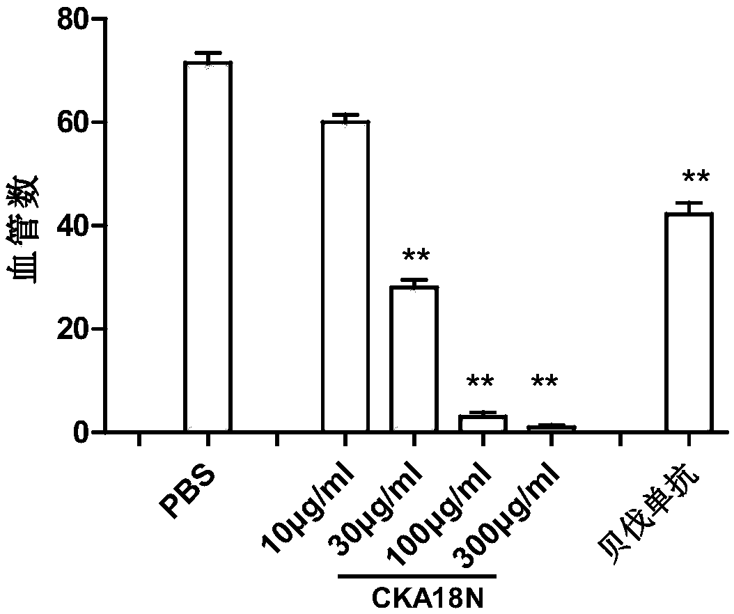 Polypeptide CKA18N for inhibiting angiogenesis and application thereof