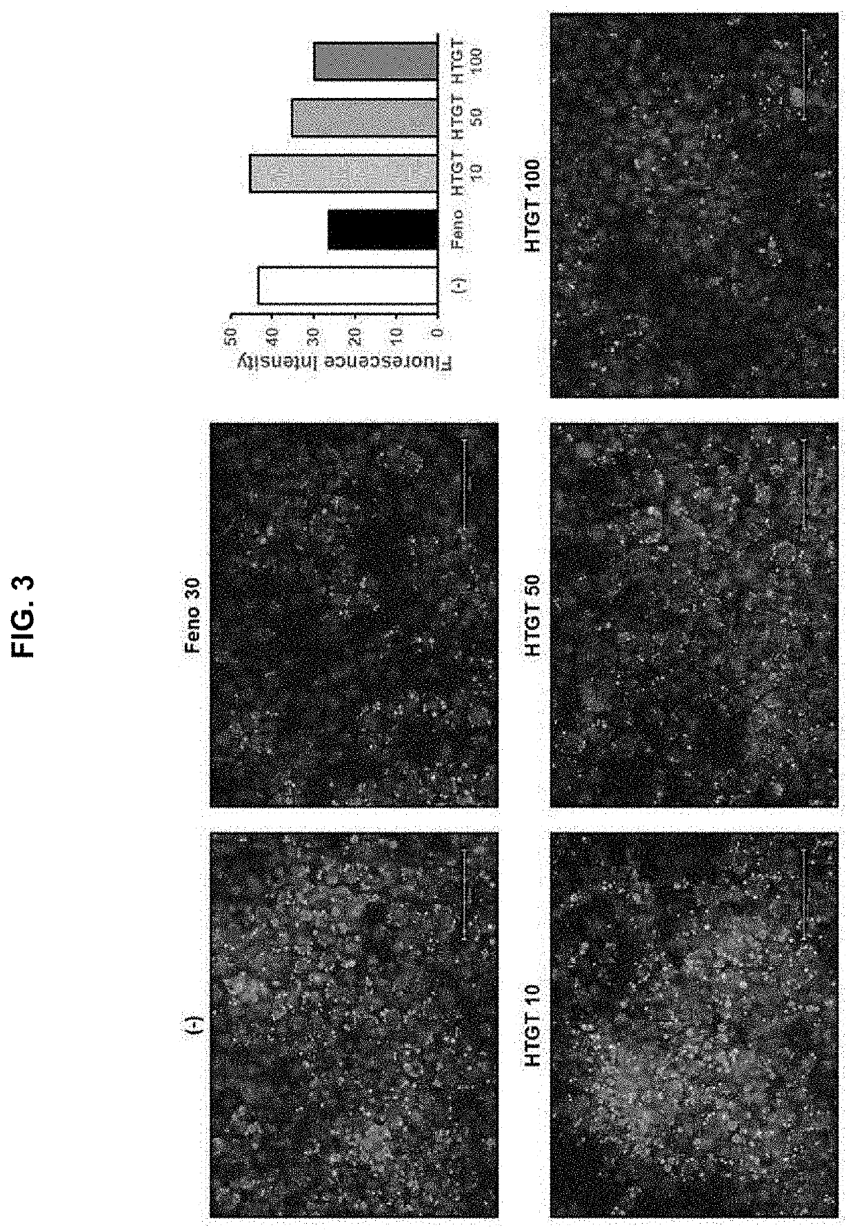 Composition for reducing body fat comprising green tea extract containing gallocatechin gallate as an active ingredient and manufacturing method thereof