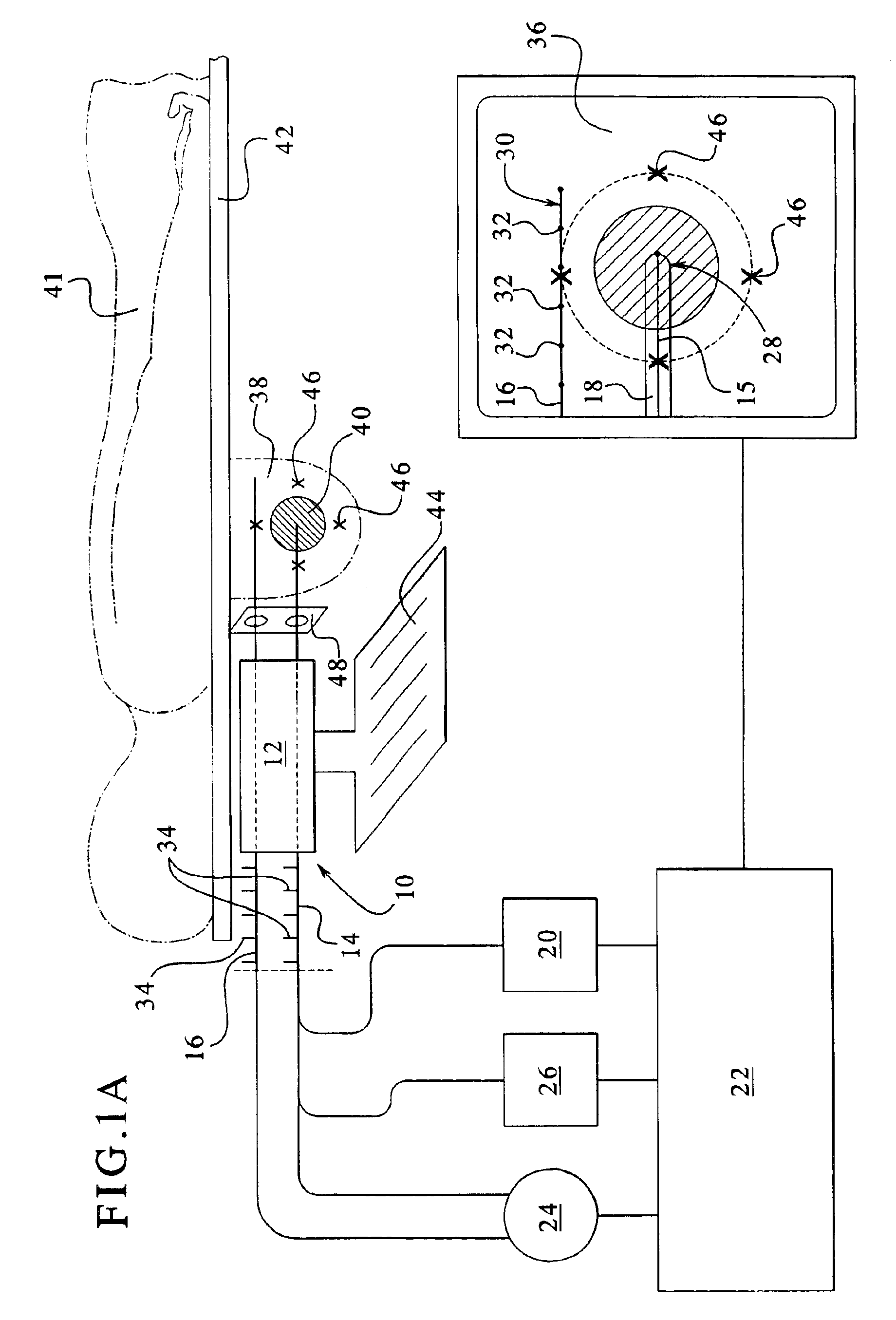 Apparatus and method for delivering ablative laser energy and determining the volume of tumor mass destroyed