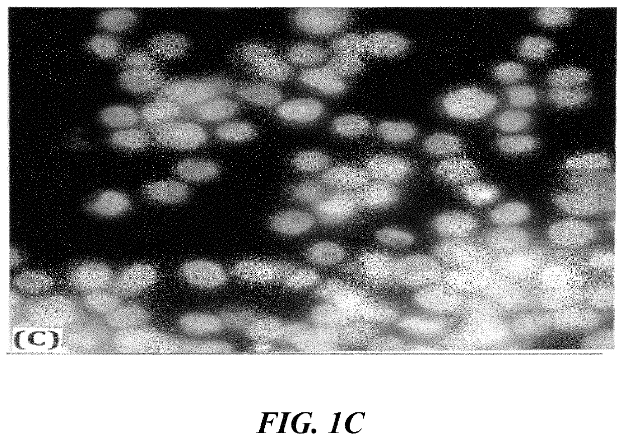 Zinc-charged pancreatic enzymes for treatment of cancer and inflammation