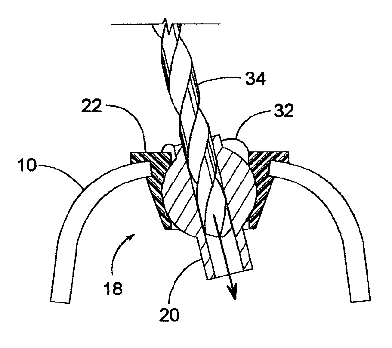 Dental implant tool with attachment feature