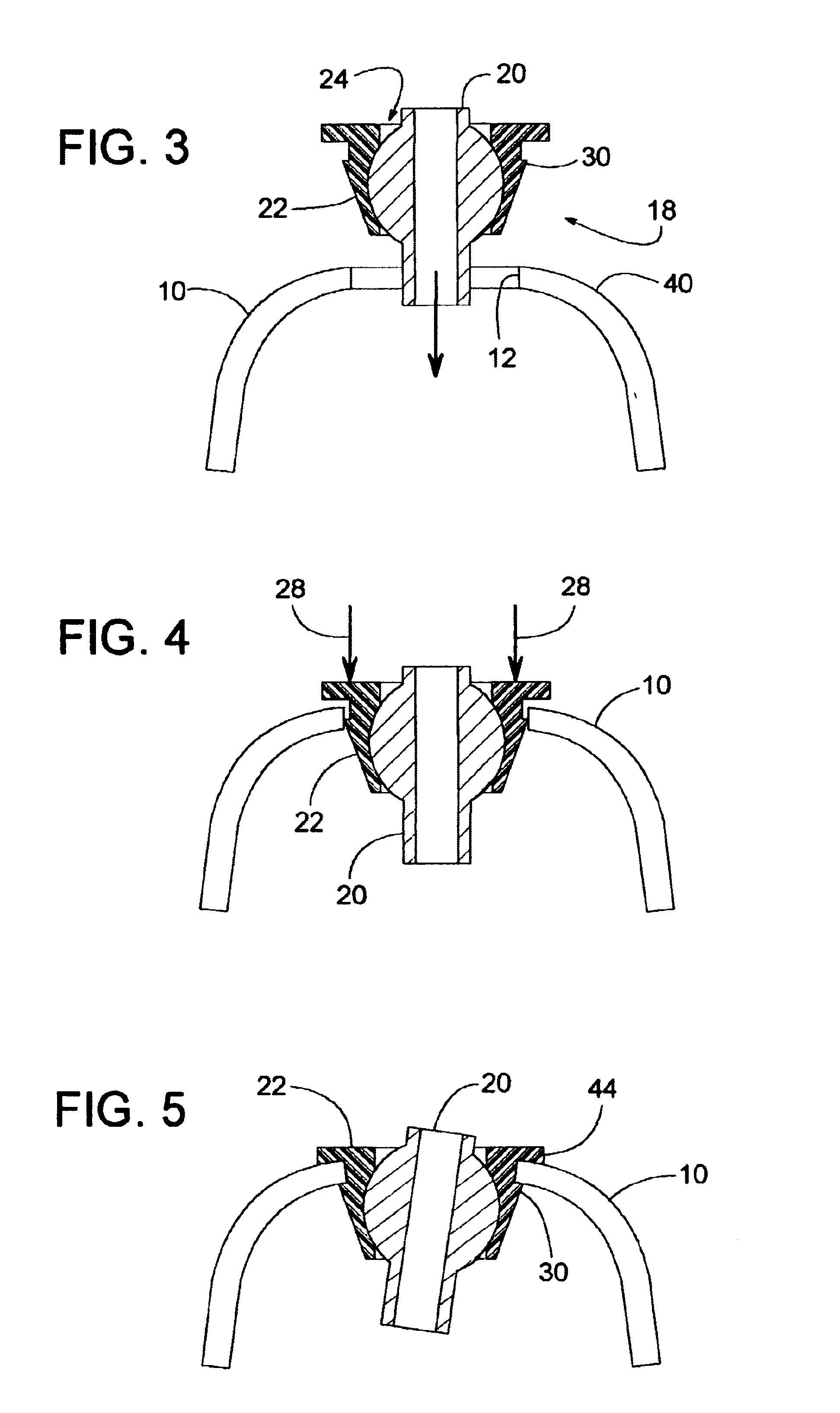 Dental implant tool with attachment feature