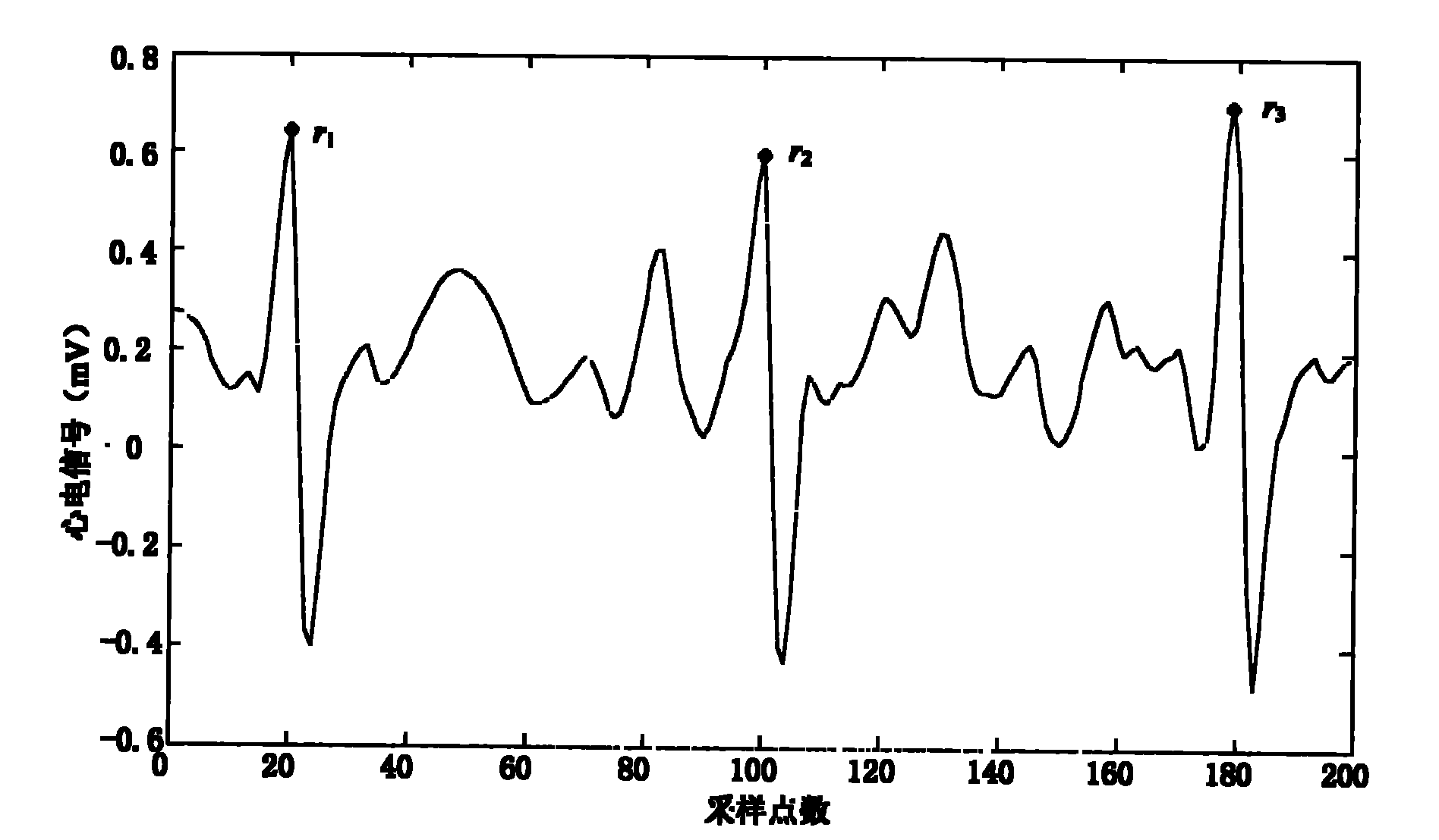 Electrocardiosignal R peak detection method based on waveform characteristic matching