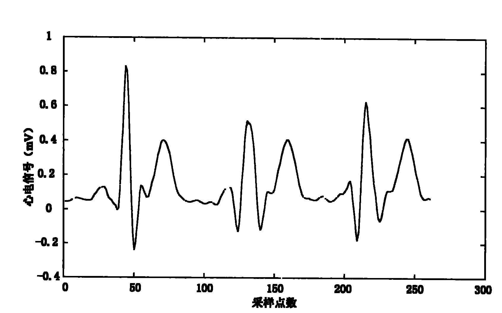 Electrocardiosignal R peak detection method based on waveform characteristic matching
