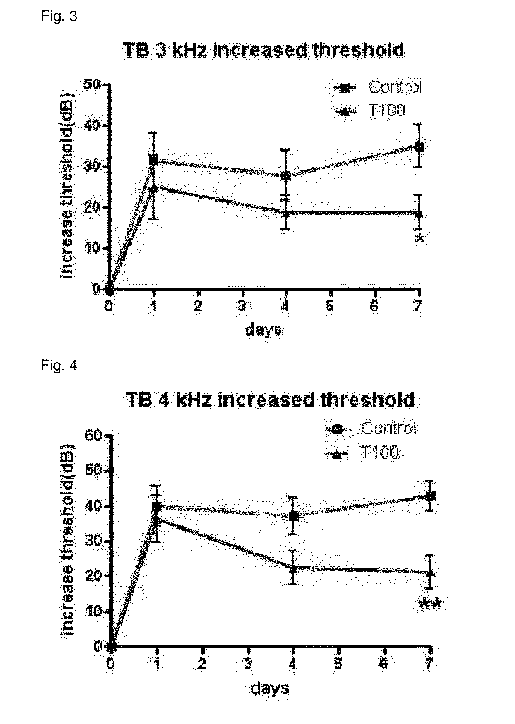 Composition for preventing or treating hearing loss