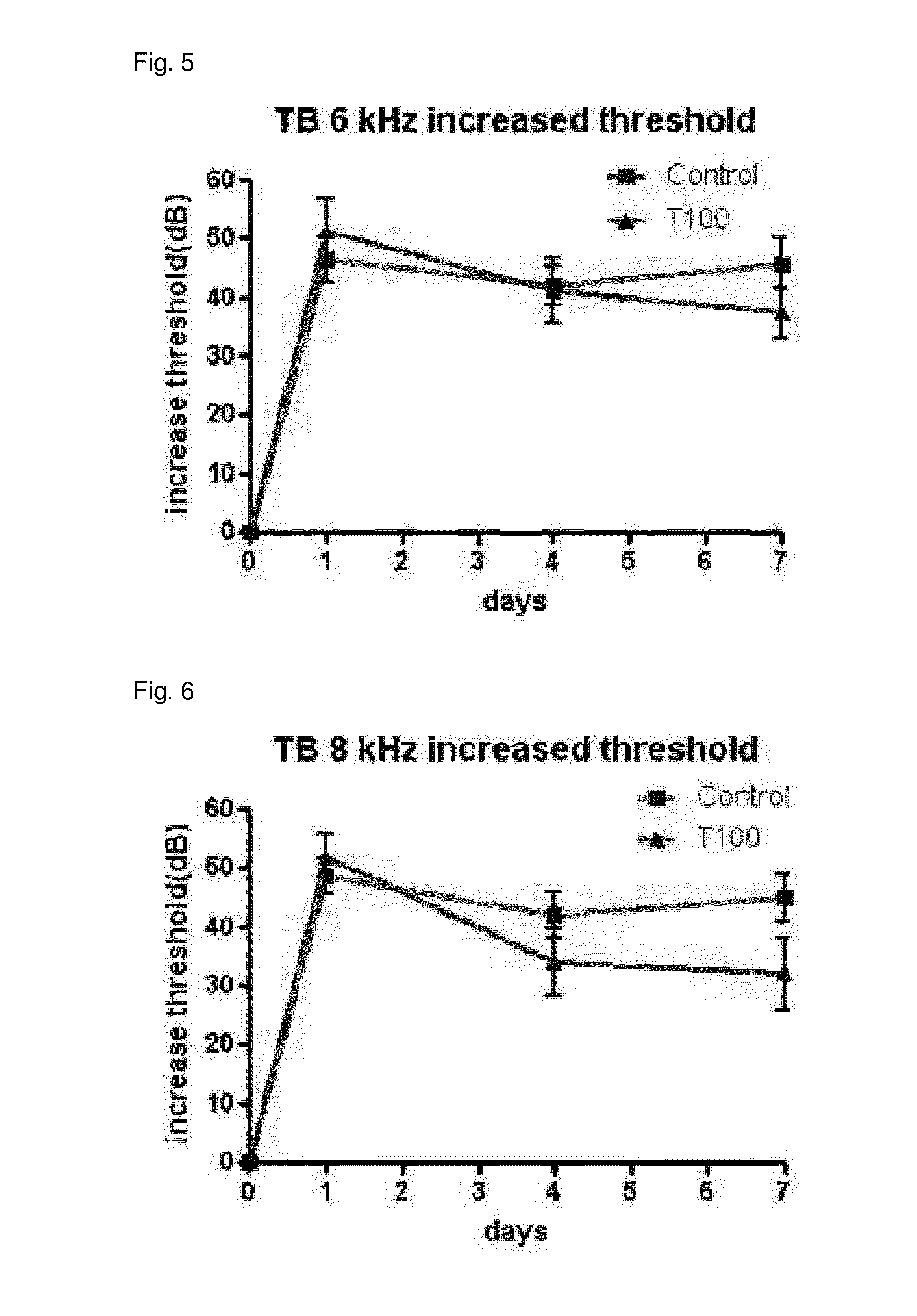 Composition for preventing or treating hearing loss