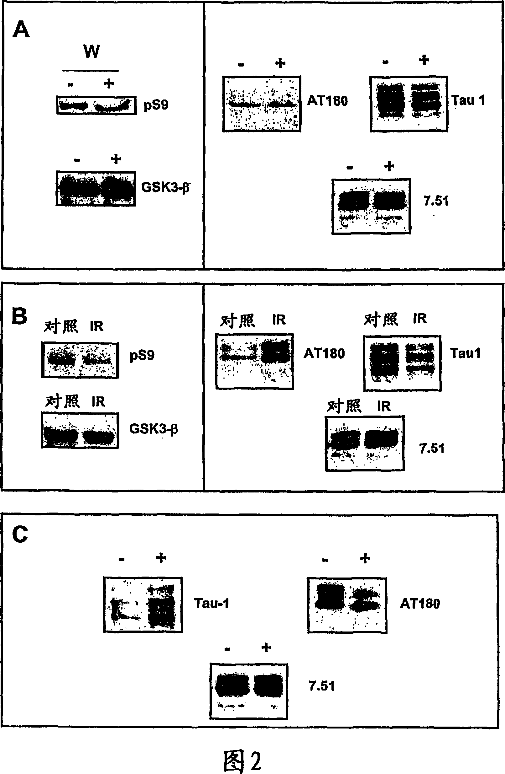 Pharmaceutical compositions comprising a tungsten salt (VI) for the treatment of neurodegenerative disorders, particularly alzheimer's disease and schizophrenia