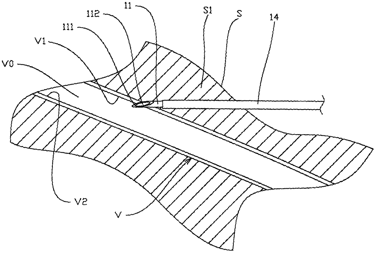 Safe-type venous indwelling needle