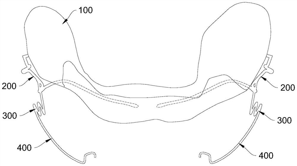 Composite dental orthodontic assembly