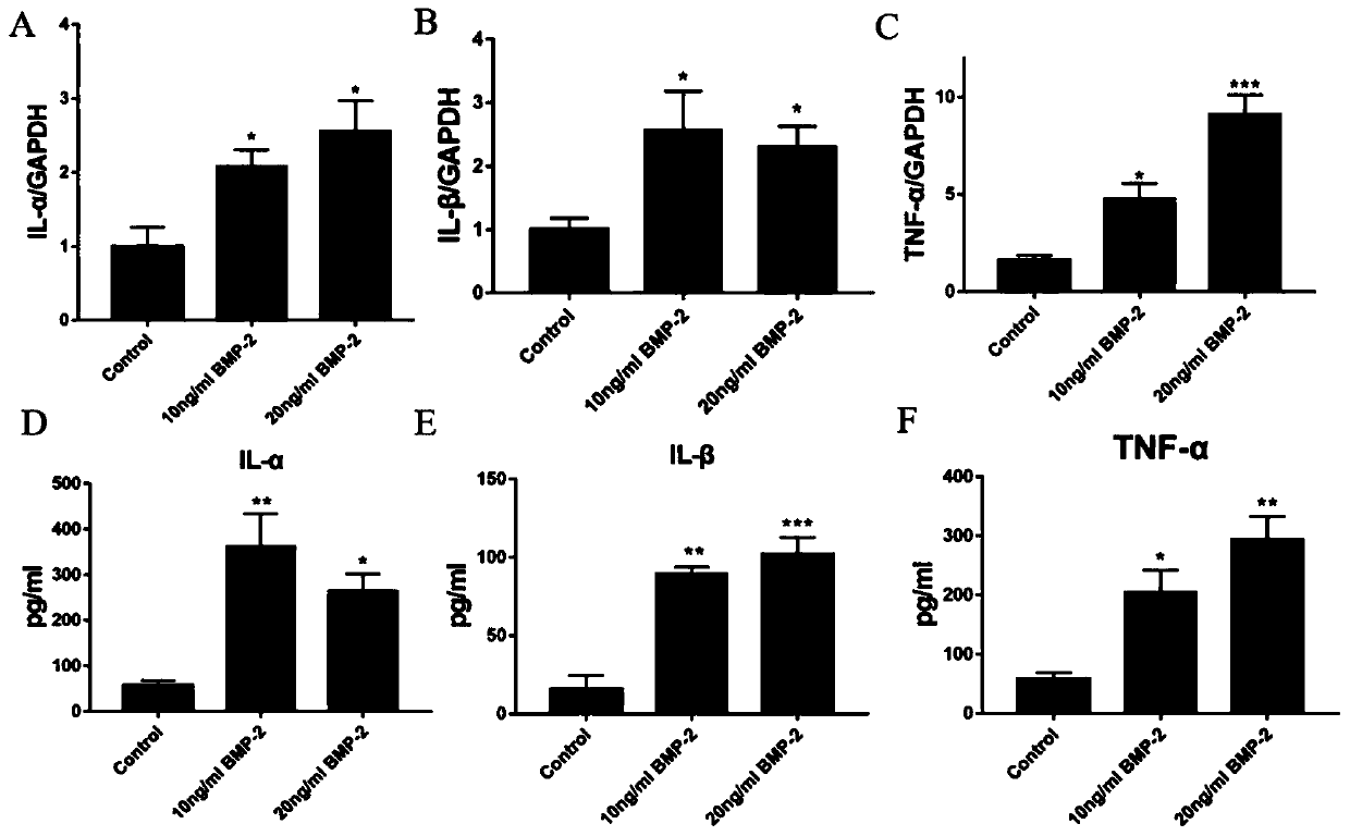 Application of zanthoxylum nitidum extract in preparation of medicine for preventing and treating spinal fusion surgery inflammation