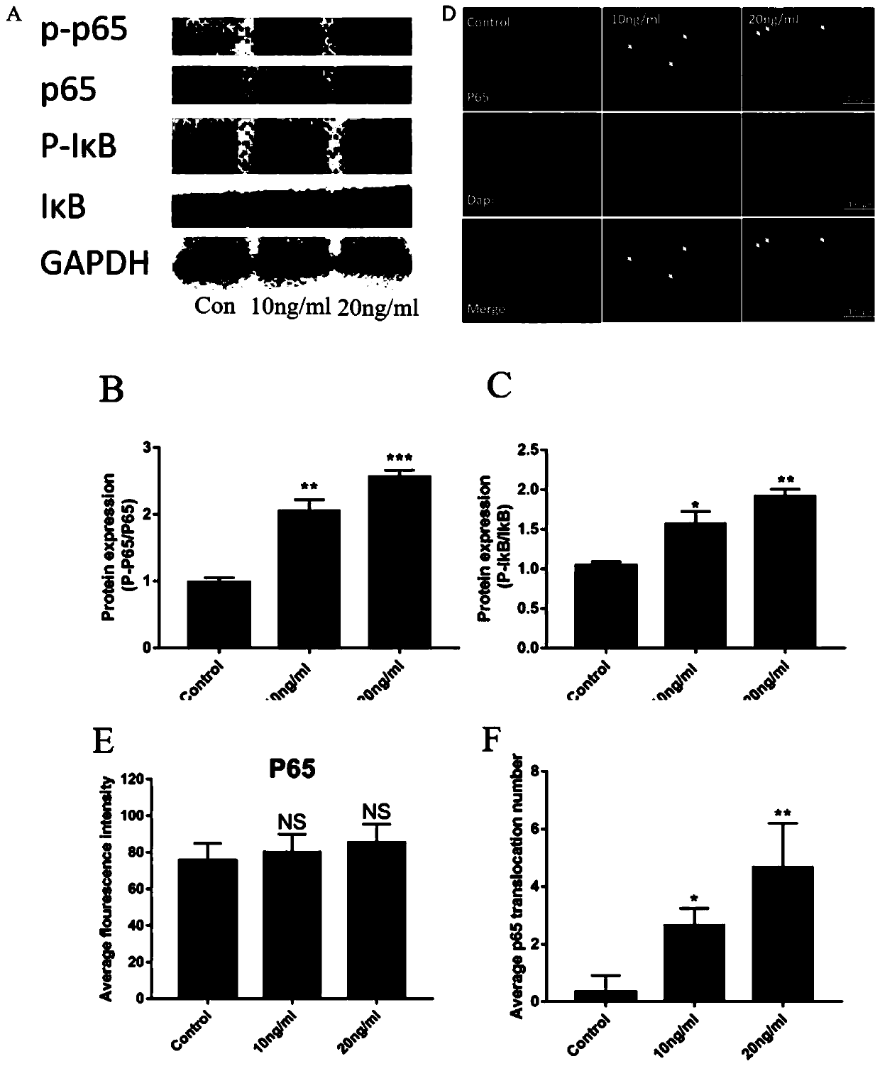 Application of zanthoxylum nitidum extract in preparation of medicine for preventing and treating spinal fusion surgery inflammation