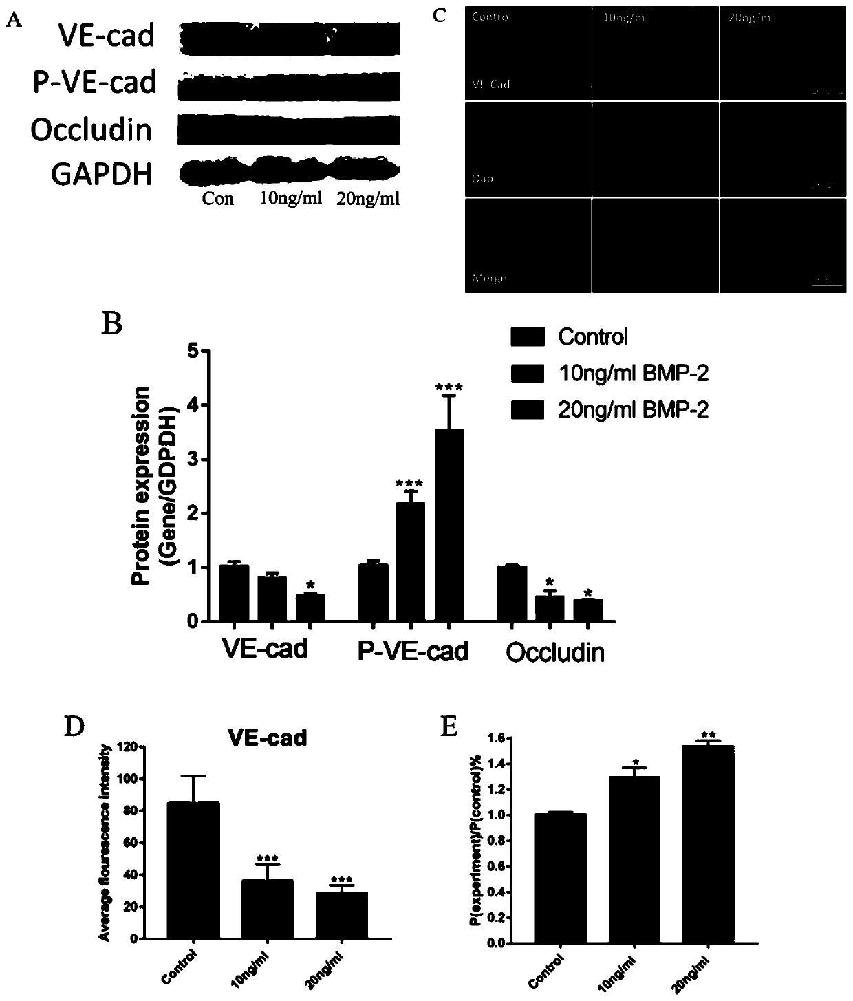 Application of zanthoxylum nitidum extract in preparation of medicine for preventing and treating spinal fusion surgery inflammation