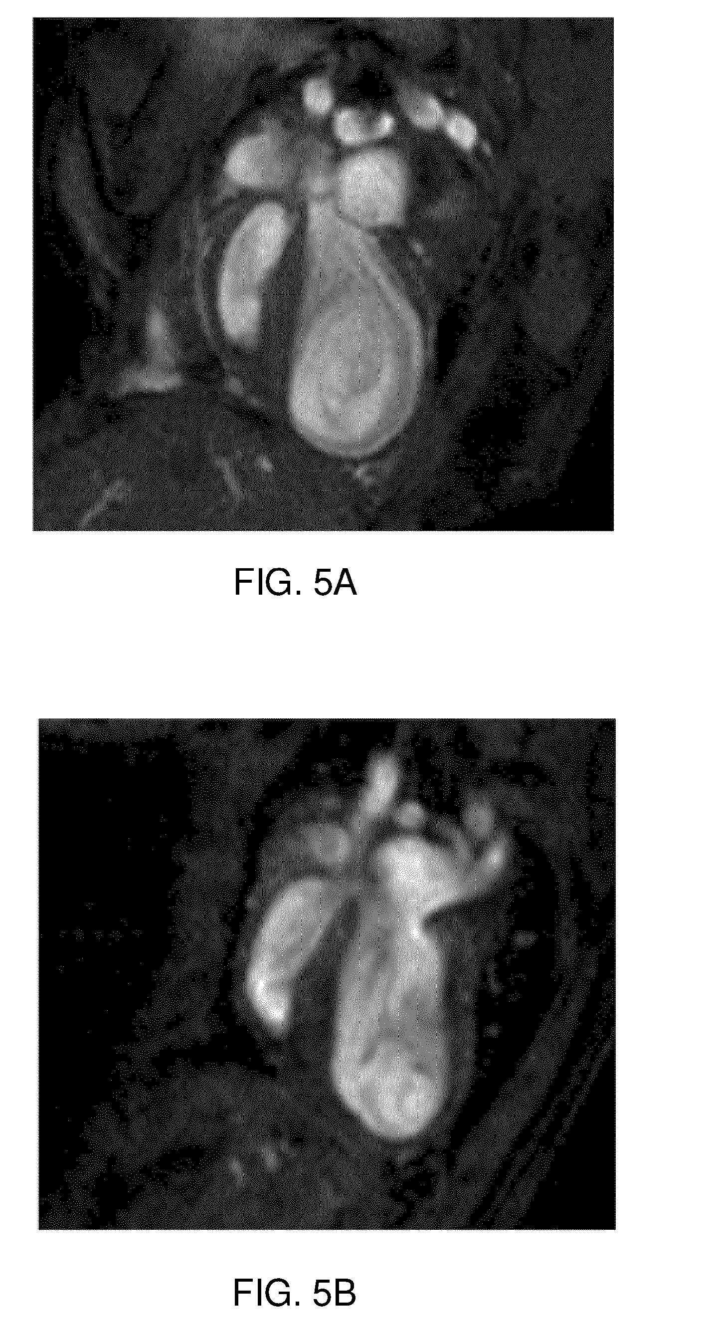 Immunoglobulin-like molecules directed against fibronectin-eda