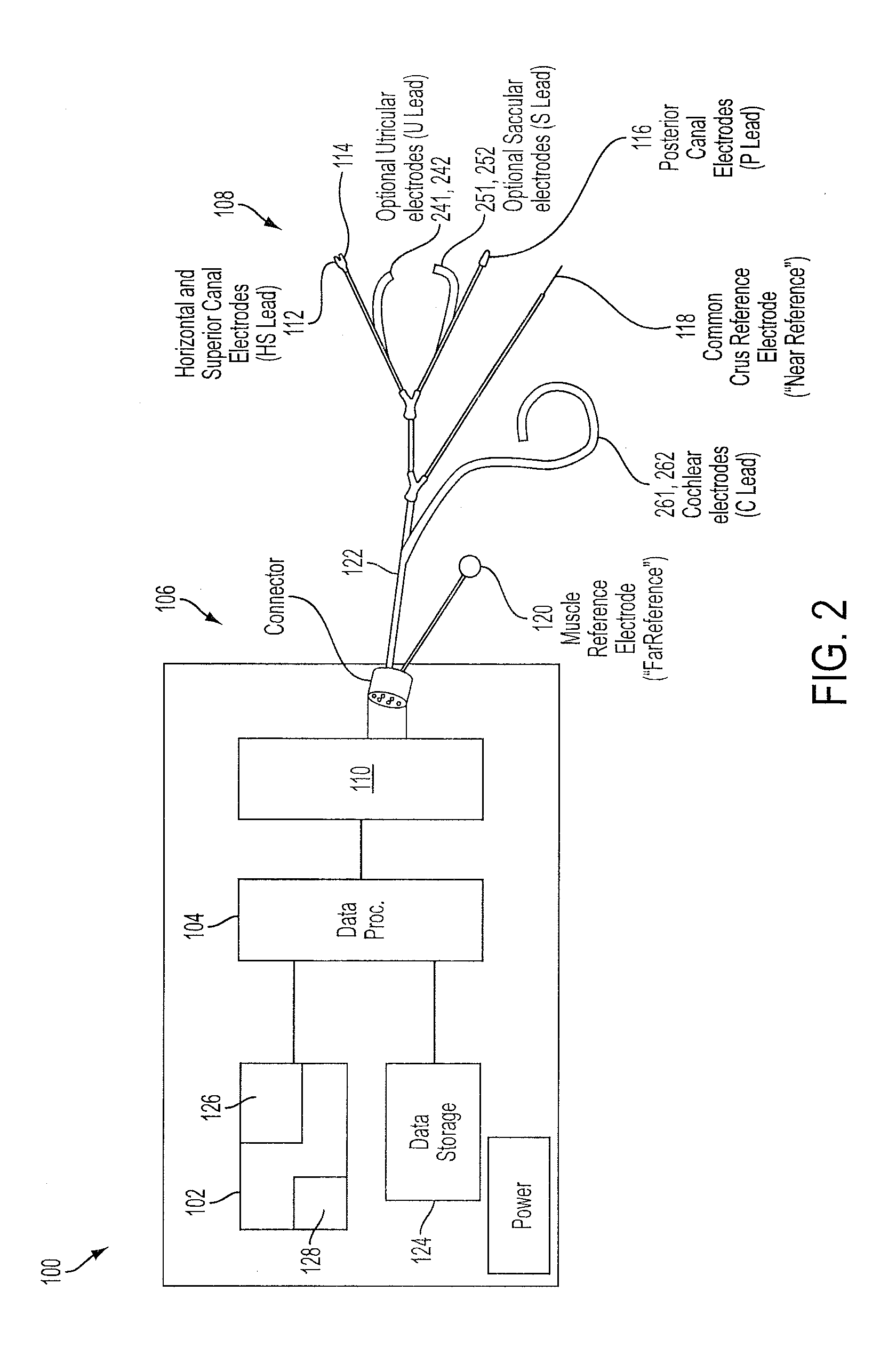 Implantable vestibular prosthesis